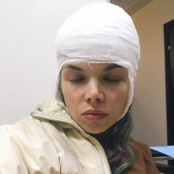 В Петербурге девушка с огромной раной от куска льда полтора часа ждала помощи врачей